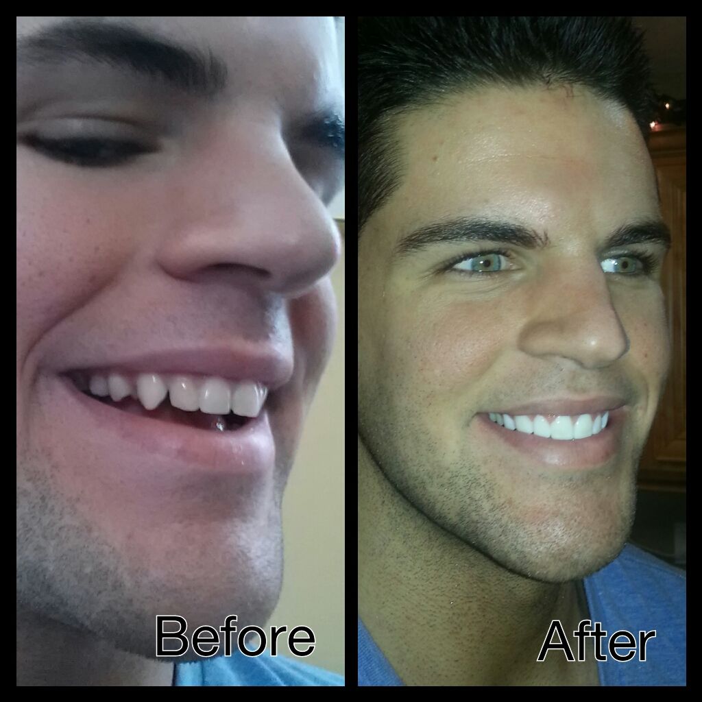 BeforeAfter_3_zpsb88fafc6.jpg